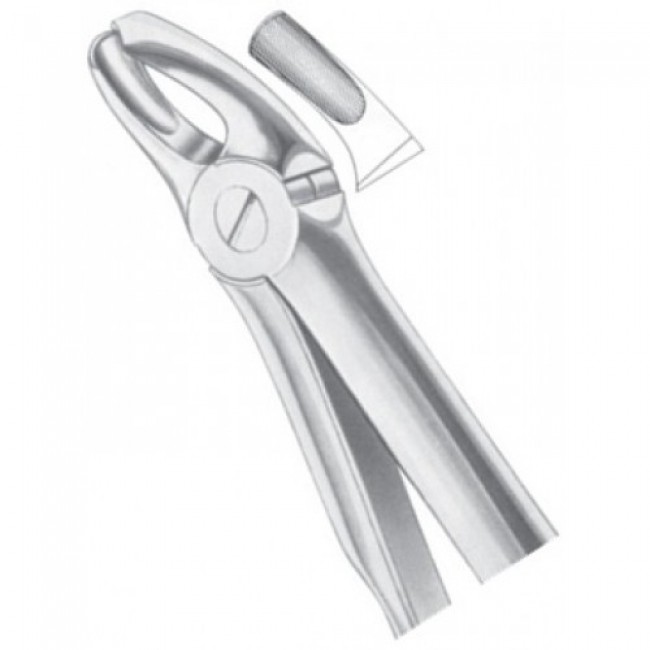 Fig 18 Upper Molars Left Fig 18 Upper Molars Left